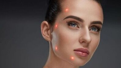 Τι είναι η κλασματική αναζωογόνηση του δέρματος